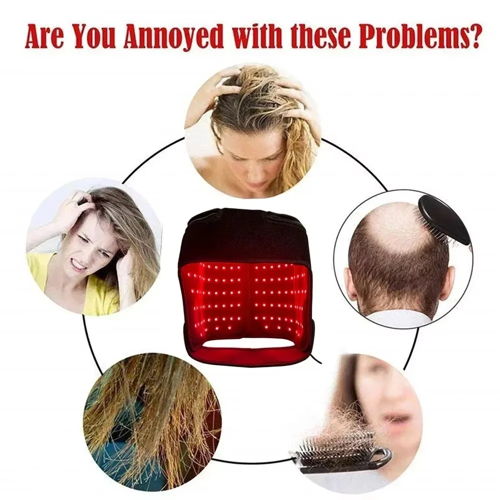LED Rood Licht Therapie Hoed V - Hair Care Frizzy Hair recensie en prijs
