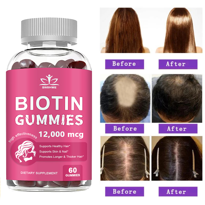 Collageen Gummies Biotine Gumm - Hair Care Gummies recensie en prijs